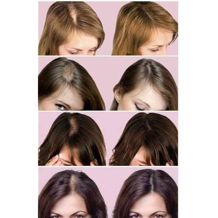 FasterThom Unisex-Adults Hair Loss Treatment Set 5 Pieces Shampoo, Conditioner, Serum, Bath Cream, Ampoule - Image 5